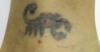 Photo for WELCOME TO INK AWAY MD TATTOO REMOVAL