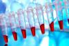Photo for Cell Line Development Market Set for Rapid Growth | Trend and Analysis, 2018-2026