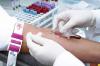 Photo for Companion Diagnostics Market Will Make a Huge Growth by 2023