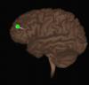 Photo for Neuro-navigation Systems Market - Product Type Optical System and Electromagnetic System