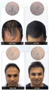 Photo for Nutralyfe Regain : Reduce your Hair Fall