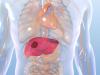 Photo for Interventional Oncology Solutions Market Ablation Radiofrequency Ablation, Cryo Ablation Therapy