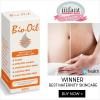 Photo for Bio Oil for Stretch Marks in pakistan