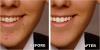 Photo for Best Dental Clinic in Delhi for Dental Implant | 9999201572