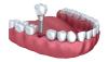 Photo for Best Dental Clinic in Delhi for best Dental Treatment
