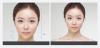 Photo for Nothing Beats South Korea Plastic Surgery Cost!