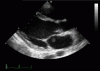Photo for Ultrasound Device Market Size, Application Analysis and Forecasts, 2016 to 2024