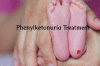 Photo for Phenylketonuria Treatment Market – Industry, Growth, Trends, Outlook, and Analysis, 2018-2026