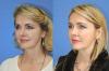 Photo for Image By Design Plastic Surgery: Melek Kayser MD