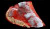 Photo for New 3D Color X-Rays to Diagnose Cancer, Heart Disease and More