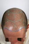 Photo for FUE Hairline Clinic
