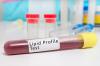 Photo for Lipid Testing Market Industry Analysis, Size, Growth, Trends and Forecast to 2025