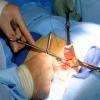 Photo for Hernia Repair Market Shares, Price Trends and Competitive Strategies, 2014 to 2024