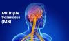 Photo for Multiple Sclerosis Therapeutics Market Forecast till 2025