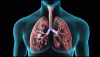Photo for Pulmonary Drugs Market Forecast till 2025