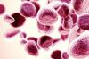 Photo for Hematopoietic Stem Cell Transplantation (HSCT) Market - Opportunity Analysis, 2018-2026