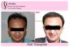 Photo for Profile Hair Transplant Centre