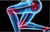 Photo for Joint Replacement Market: Key Companies | Global Industry Report, 2018-2024