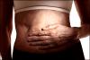 Photo for Carcinoid Syndrome Diarrhea Treatment Market Opportunity Analysis, 2026