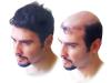 Photo for Provillus--Hair Loss Treatment