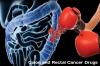 Photo for Colon and Rectal Cancer Drugs Market – Industry Size, Growth, outlook and Analysis, 2018–2026
