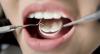 Photo for Enhance your Eating ability with Dental Implant in Delhi