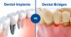 Photo for 10% off on Dental Implants at Best Dental Clinic in Delhi