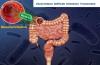 Photo for Clostridium Difficile Infection Treatment Market Growth, Size, Trends and Analysis, 2018-2026