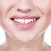 Photo for Invisalign Dental Clinic in Westlake, Austin