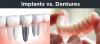 Photo for Best Implant Dentist in Delhi for best Dental Treatment