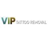 Photo for VIP Tattoo Removal - Las Vegas