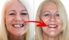 Photo for Get 10% of on Dental implant in Delhi