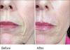 Photo for What are the benefits of the spa?