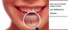 Photo for Save money on Dental Implants in Delhi