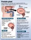 Photo for Best Natural Prostate Remedy At Full Of Health Inc