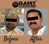 Photo for Classy Grafts - Hair Transplant Centre