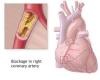 Photo for Reduce Triglycerides