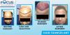 Photo for Focus Hair Transplant Centre