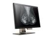 Photo for Monochrome Medical Monitor Market Growth Opportunities Till 2026