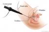 Photo for Cystoscope Market Definitions, Classifications, Applications and Overview