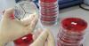 Photo for The global infectious disease diagnostics market size was valued at US$ 15,112.2 million in 2017, and is expected to witness a robust CAGR of 6.1% over the forecast period (2018 – 2026).