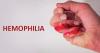 Photo for Hemophilia Treatment Market Analysis of Top Players, Share, Growth, Region Wise, Application and Forecasts by 2025