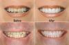 Photo for Excel Dental Office San Marcos CA