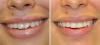Photo for Emergency Dentist NYC