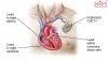 Photo for Cardiac Implants Market - Global Industry Analysis, Share, Growth, Trends, and Forecast 2024