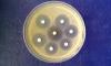 Photo for Advancements Towards the Development of Rapid Antimicrobial susceptibility testing (AST) Methods