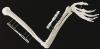 Photo for Bone implants Market: Boosting the Healthcare Industry Worldwide 2018-2023