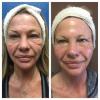 Photo for Aesthetica Med Spa of San Diego