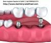 Photo for Best Implant Dentist in Delhi | Call 9999201572