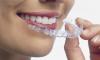 Photo for Porcelain Veneers NYC, Manhattan